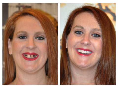 Bain de bouche New Teeth