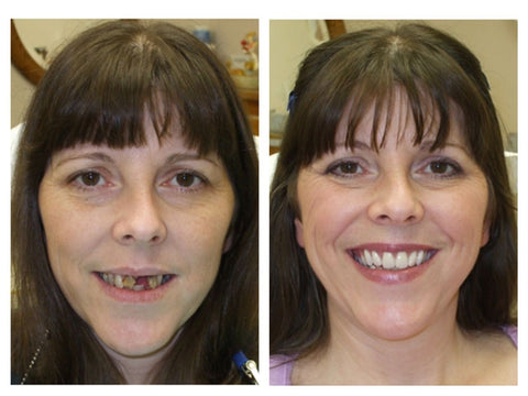 Bain de bouche New Teeth