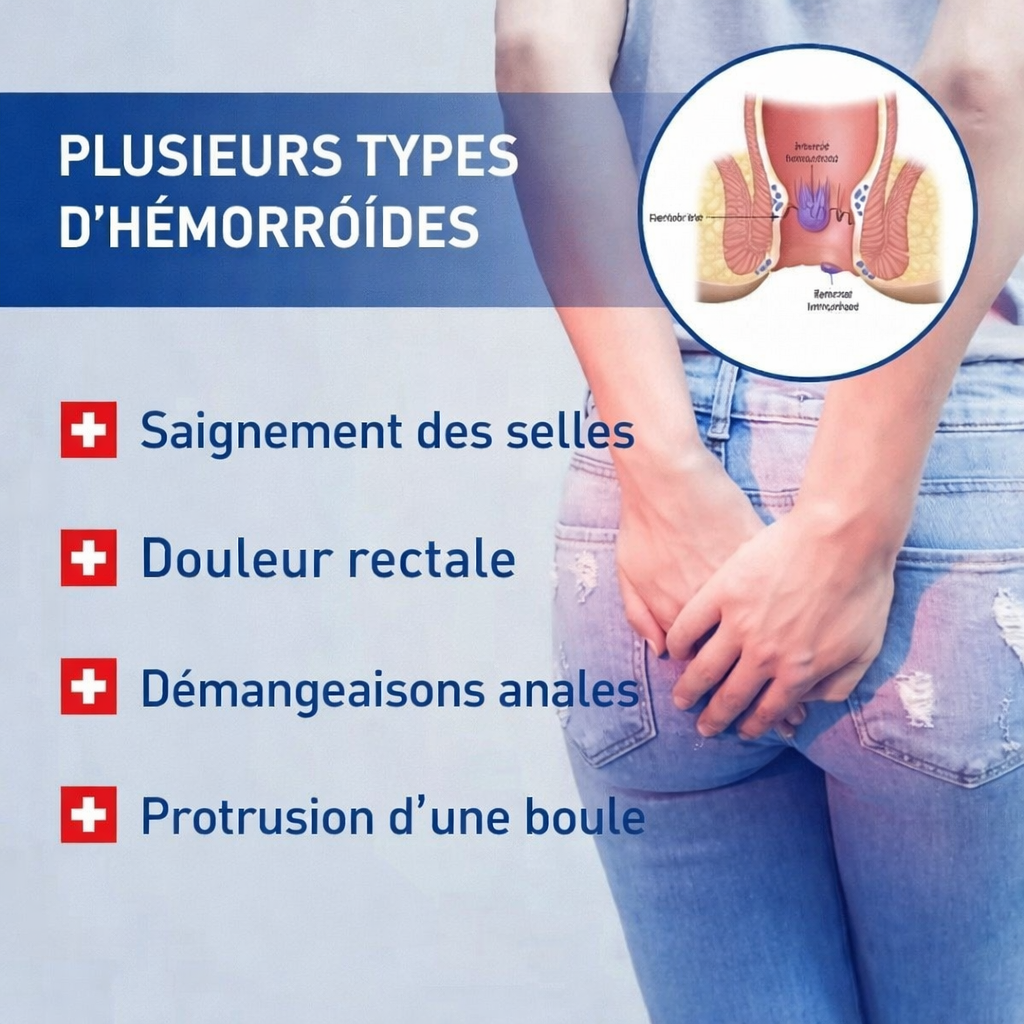 Crème contre  des Hémorroïdes – Soulagement rapide des Hémorroïdes.