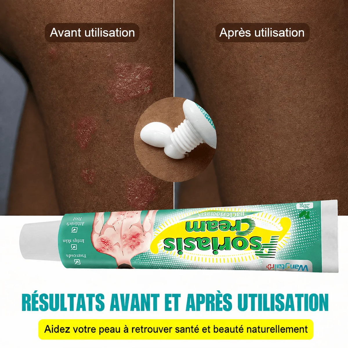 Démangeaisons, Irritations, Inconfort  dans les zones sensibles ? La Solution  Rapide & Efficace pour  une peau plus confortable