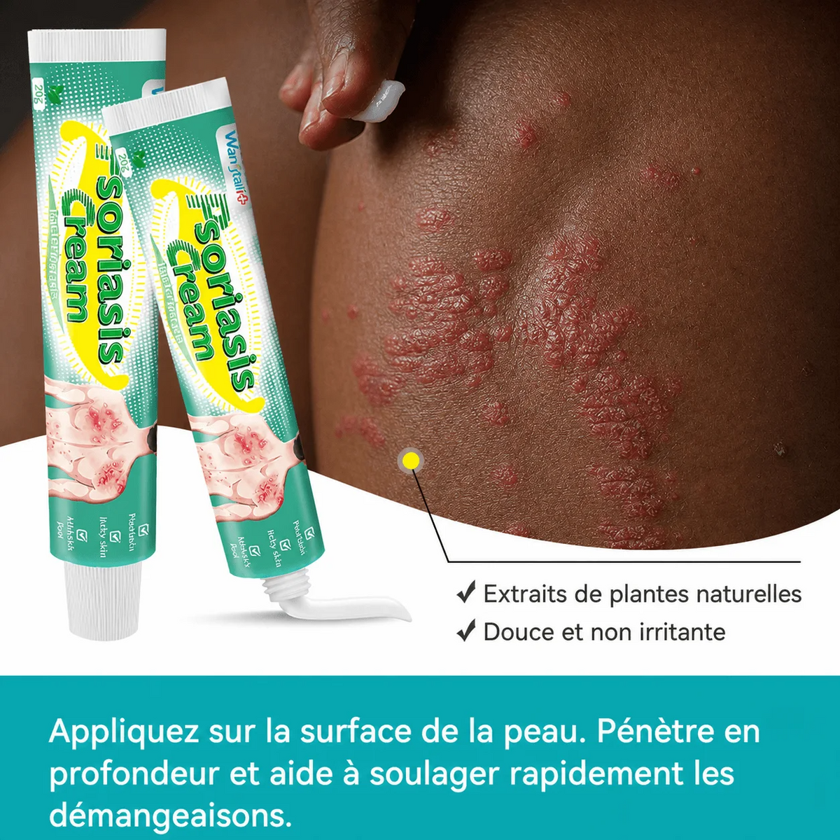 Démangeaisons, Irritations, Inconfort  dans les zones sensibles ? La Solution  Rapide & Efficace pour  une peau plus confortable