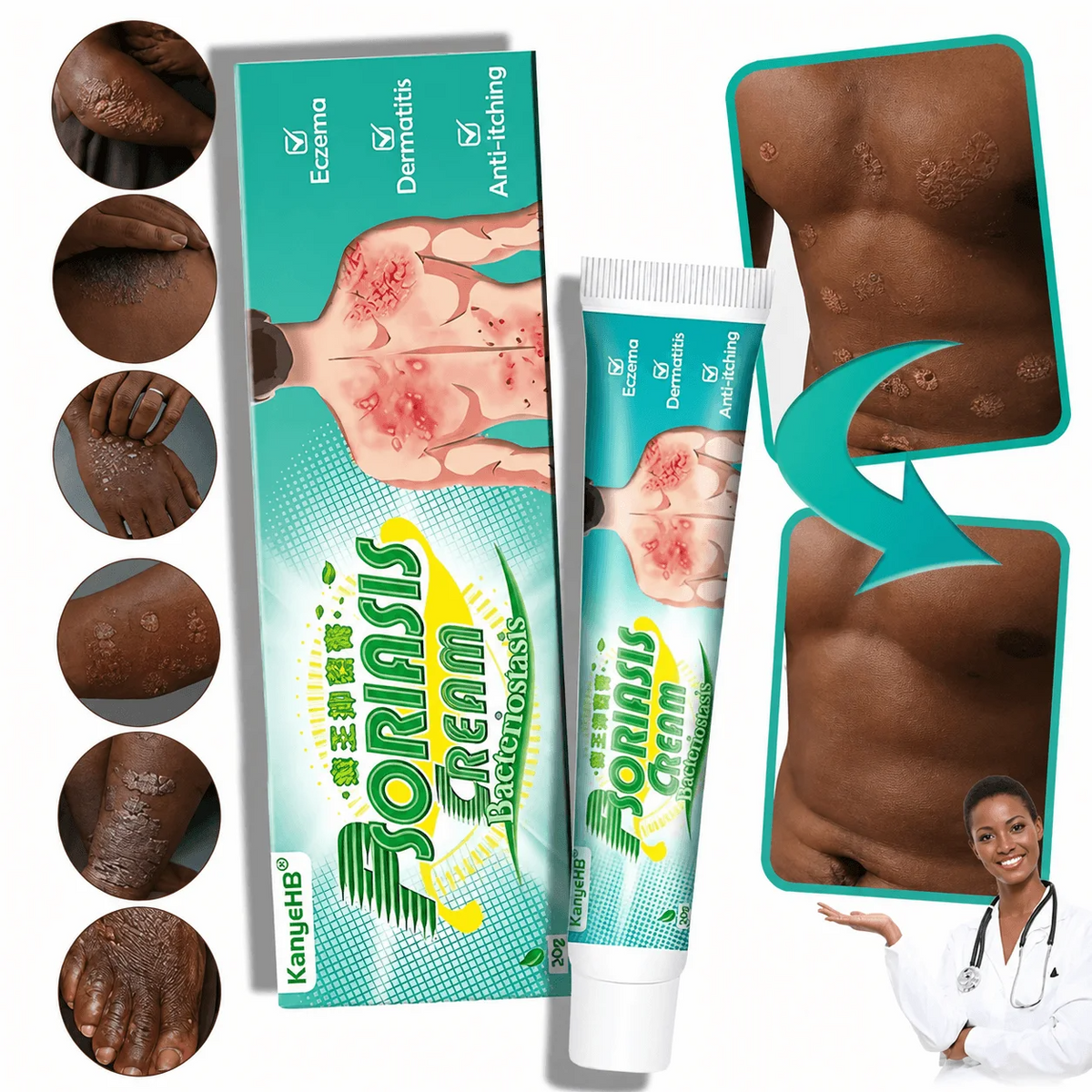 Démangeaisons, Irritations, Inconfort  dans les zones sensibles ? La Solution  Rapide & Efficace pour  une peau plus confortable